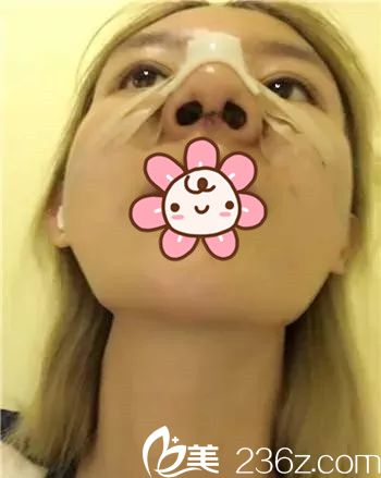 術(shù)后當(dāng)天 術(shù)后當(dāng)天