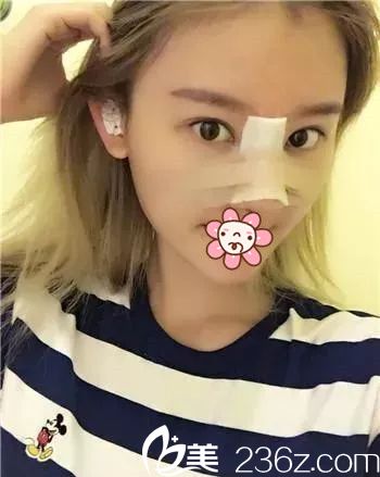 三天后狀態(tài)還不錯 三天后狀態(tài)還不錯