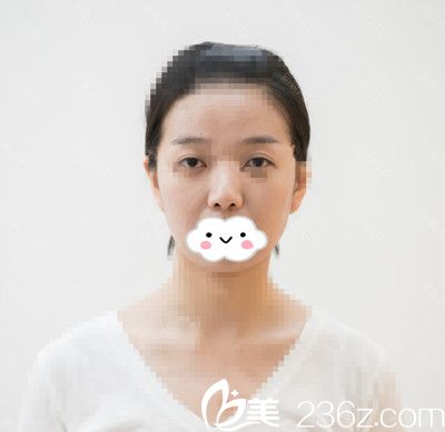 手術(shù)前的我 手術(shù)前的我