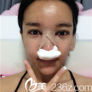 手術(shù)當(dāng)天的我 手術(shù)當(dāng)天的我