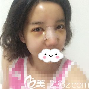 術(shù)后第三天 術(shù)后第三天