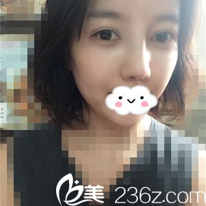 術(shù)后半個月 術(shù)后半個月