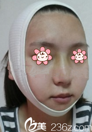 術(shù)后第三天