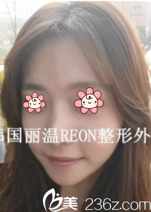 大半個(gè)月后心情好a