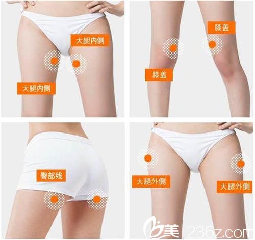 勞波兒整形醫(yī)院大腿吸脂示意圖 勞波兒整形醫(yī)院大腿吸脂示意圖
