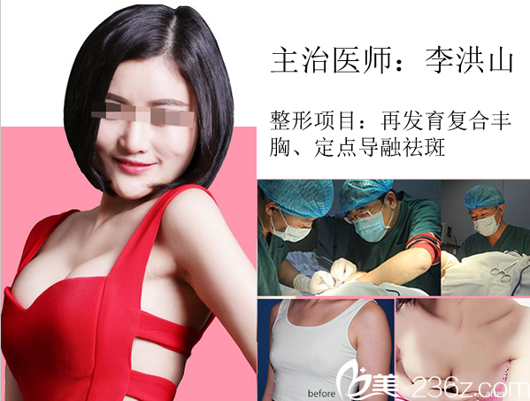 宜賓瑪麗亞李洪山院長豐胸案例 宜賓瑪麗亞李洪山院長豐胸案例