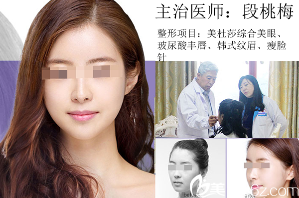 段桃梅瘦臉、玻尿酸豐唇豐唇案例