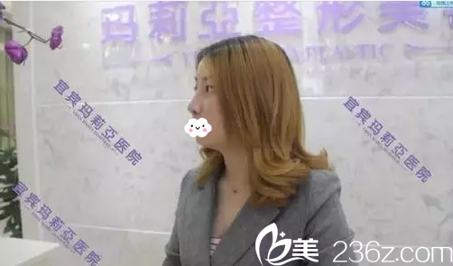 宜賓瑪莉亞整形醫(yī)院鼻綜合案例 宜賓瑪莉亞整形醫(yī)院鼻綜合案例