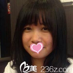 術(shù)前大餅?zāi)? alt=