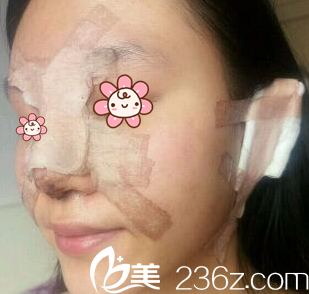 宋寅洙院長給我手術(shù)完第二天 宋寅洙院長給我手術(shù)完第二天