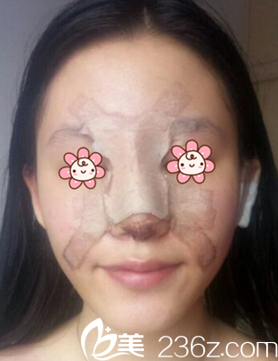 術(shù)后第四天 術(shù)后第四天