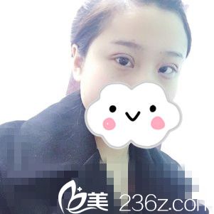 手術(shù)當(dāng)天 手術(shù)當(dāng)天