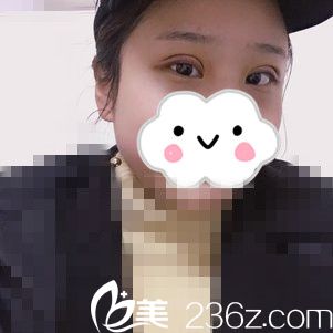 術(shù)后第三天 術(shù)后第三天