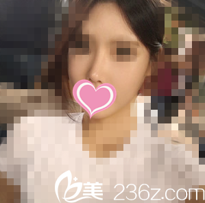 做過一次鼻整形的我較終選擇在韓國(guó)加美整形醫(yī)院進(jìn)行鼻修復(fù)手術(shù)！