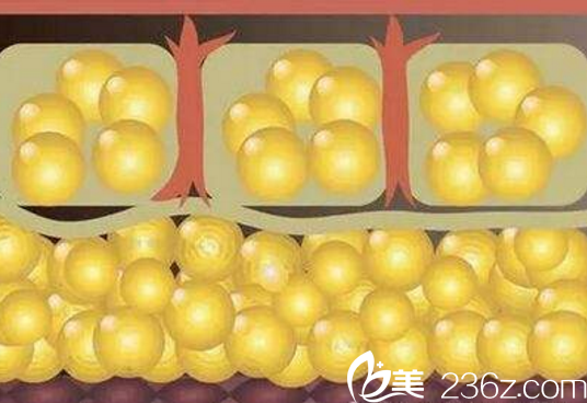 脂肪細(xì)胞體積