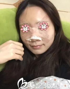 術(shù)后第二天 術(shù)后第二天