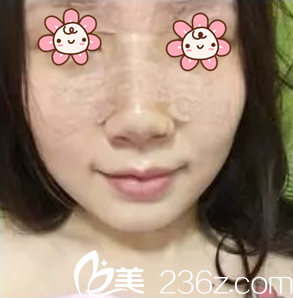 張裕珍院長給我做完五天咯 張裕珍院長給我做完五天咯