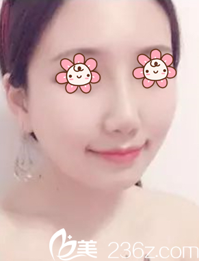 第13天效果 第13天效果