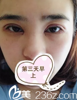 三天了，形狀還可以