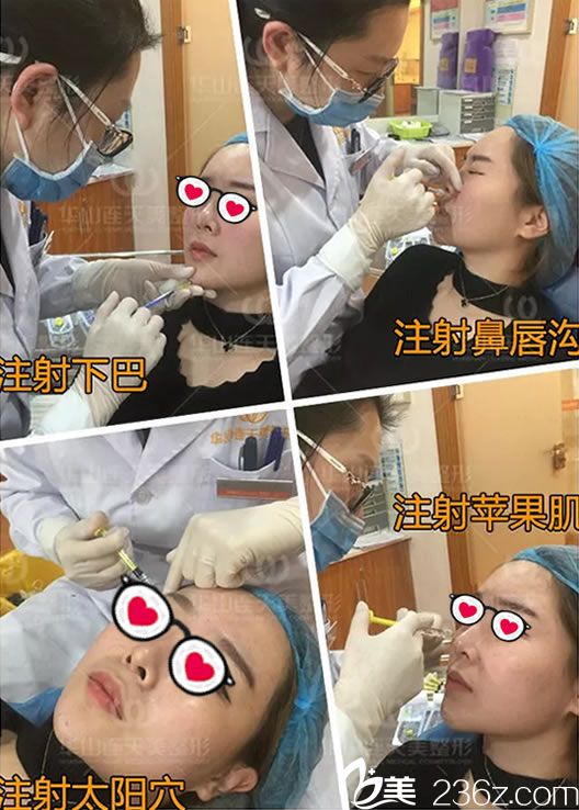 義烏連天美玻尿酸注射全過(guò)程