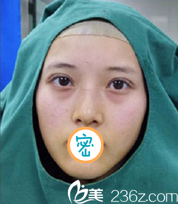 術(shù)后即刻無明顯出血及腫脹 術(shù)后即刻無明顯出血及腫脹