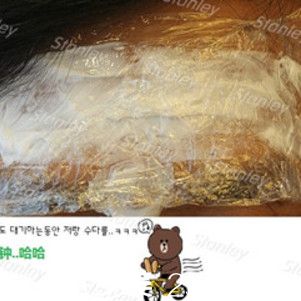 韓國史丹利整形醫(yī)院玻尿酸除皺