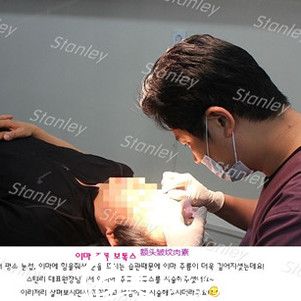 李恩錫玻尿酸除皺