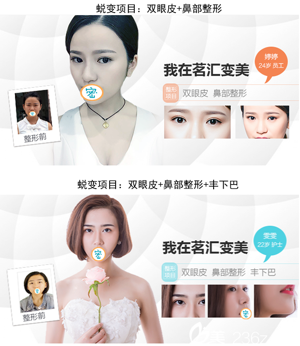 綿陽(yáng)茗匯醫(yī)療美容醫(yī)院部分塑美案例