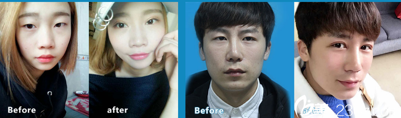 楊將打造的案例 楊將打造的案例