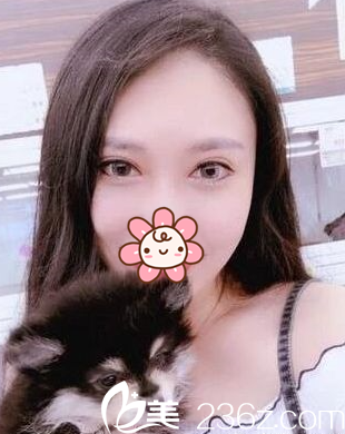 做生意賺了點(diǎn)小錢到韓國(guó)江南DNA整形做了個(gè)埋線雙眼皮+祛眼袋