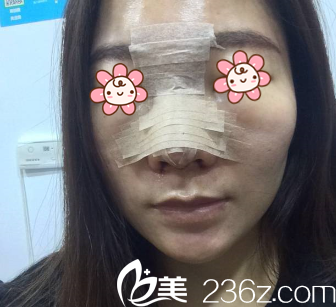 術(shù)后第三天