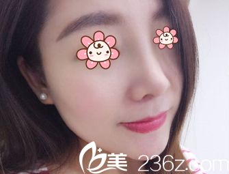 我媽朋友夸我標(biāo)致，哈哈