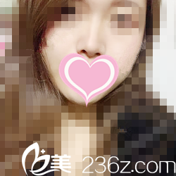 術后一個月情況