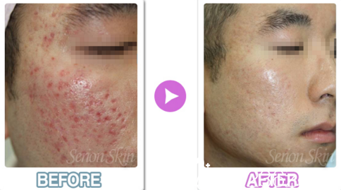 醫(yī)院真人案例 醫(yī)院真人案例