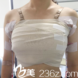 術(shù)后第二天