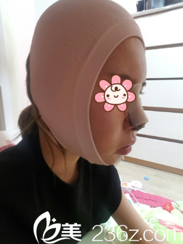 快拆線了 快拆線了