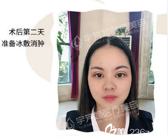 術(shù)后<span style= 術(shù)后<span style=