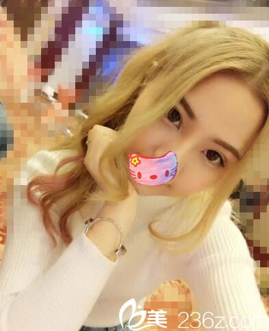 去韓國abc找高卿豪做了全切雙眼皮，變身洋娃娃