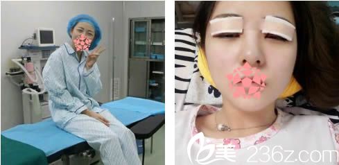 剛做完全切雙眼皮的照片 剛做完全切雙眼皮的照片