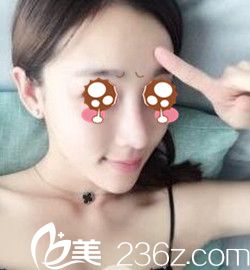 南陽(yáng)維多利亞隆鼻后半個(gè)月