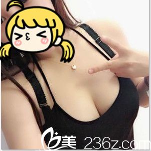 贛州儷人整形醫(yī)院真人案例 贛州儷人整形醫(yī)院真人案例