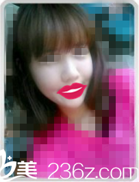 術(shù)后半個月恢復(fù)情況 術(shù)后半個月恢復(fù)情況