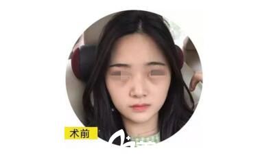 術(shù)前照片 術(shù)前照片