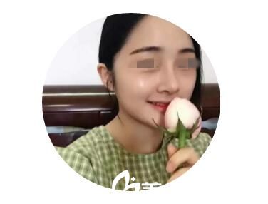 宜昌蕾帝真人案例：隆鼻后的我在聚會(huì)上驚艷了所有老同學(xué)