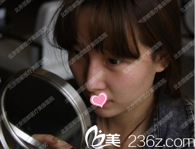 注射后當(dāng)天照片