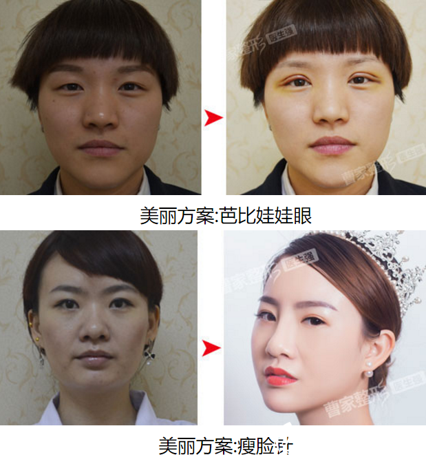 <!--<i data=20240703-sp></i>-->打造的案例