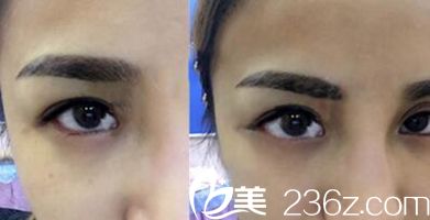 懶女人在南陽天后整形的半紋繡變美修成記新鮮出爐了!