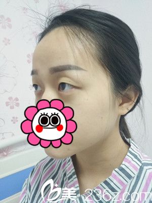 手術(shù)之前 手術(shù)之前