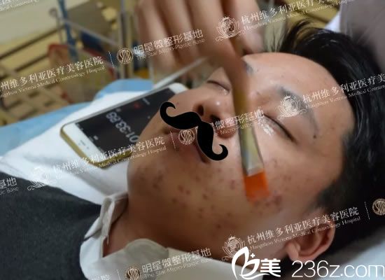 維多利亞果酸治療青春痘過程