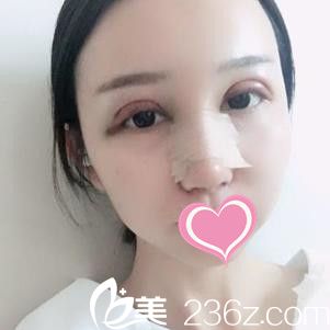 九江瑞麗做雙眼皮怎么樣 九江瑞麗做雙眼皮怎么樣